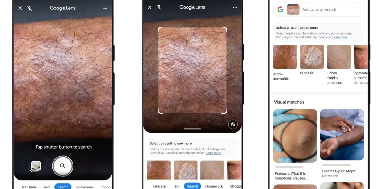 Google Lens identifica problemas na pele