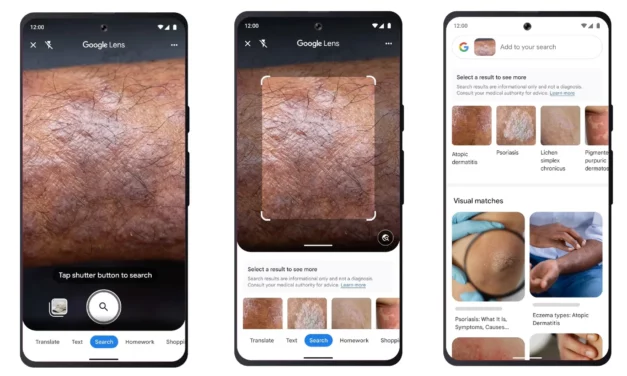 Google Lens identifica problemas na pele