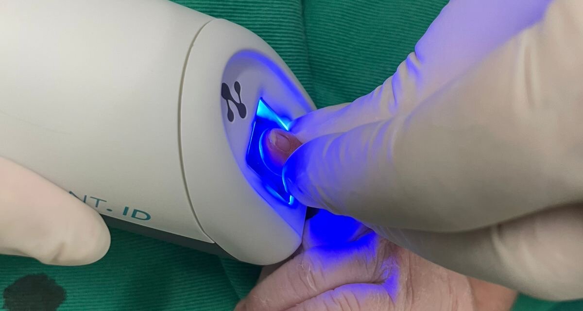Infant.ID alcança 320 mil identificações biométricas em 10 anos